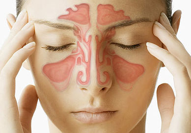 sinusitis